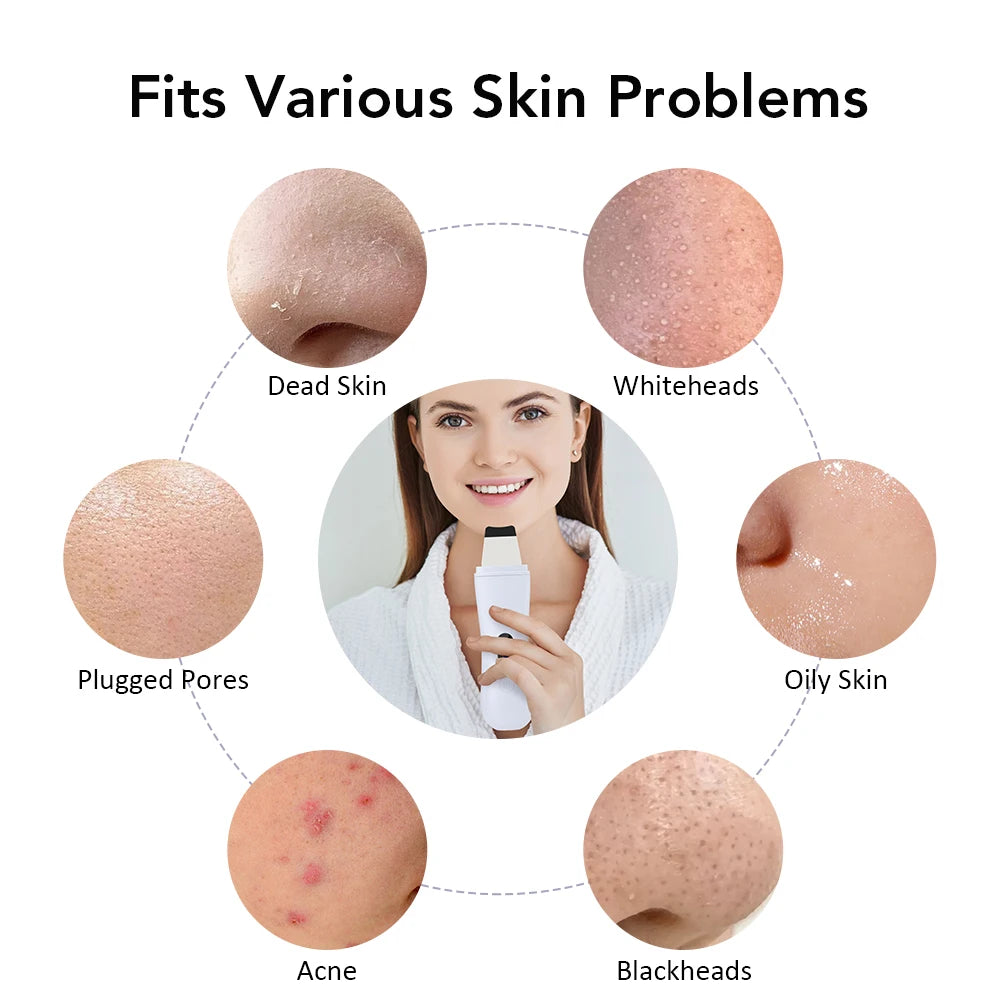 Ultrasonic Skin Scrubber 4 Modes